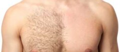 depilacao-masculinaem-santa-cruz-do-sul-1443034496