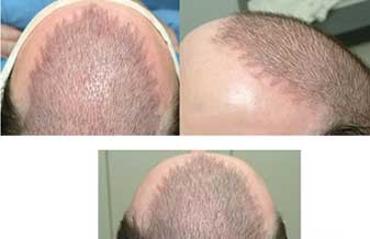 A Rainha Dos Cabelos - Foto 1