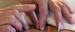 acupunturaem-santa-cruz-do-sul-1444049507