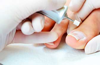 Benstar Pé - Foto 1