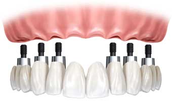 LABORATÓRIO DE PROTÉSE CARLOS TREIN - Foto 1